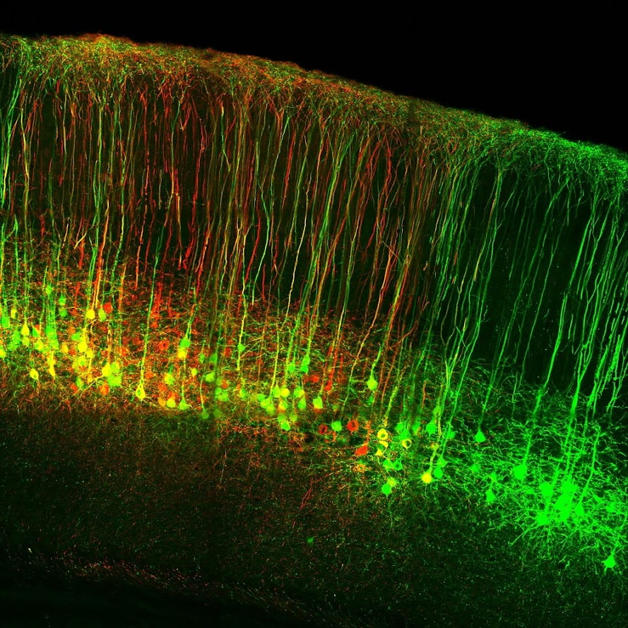 Spinal cord neurons