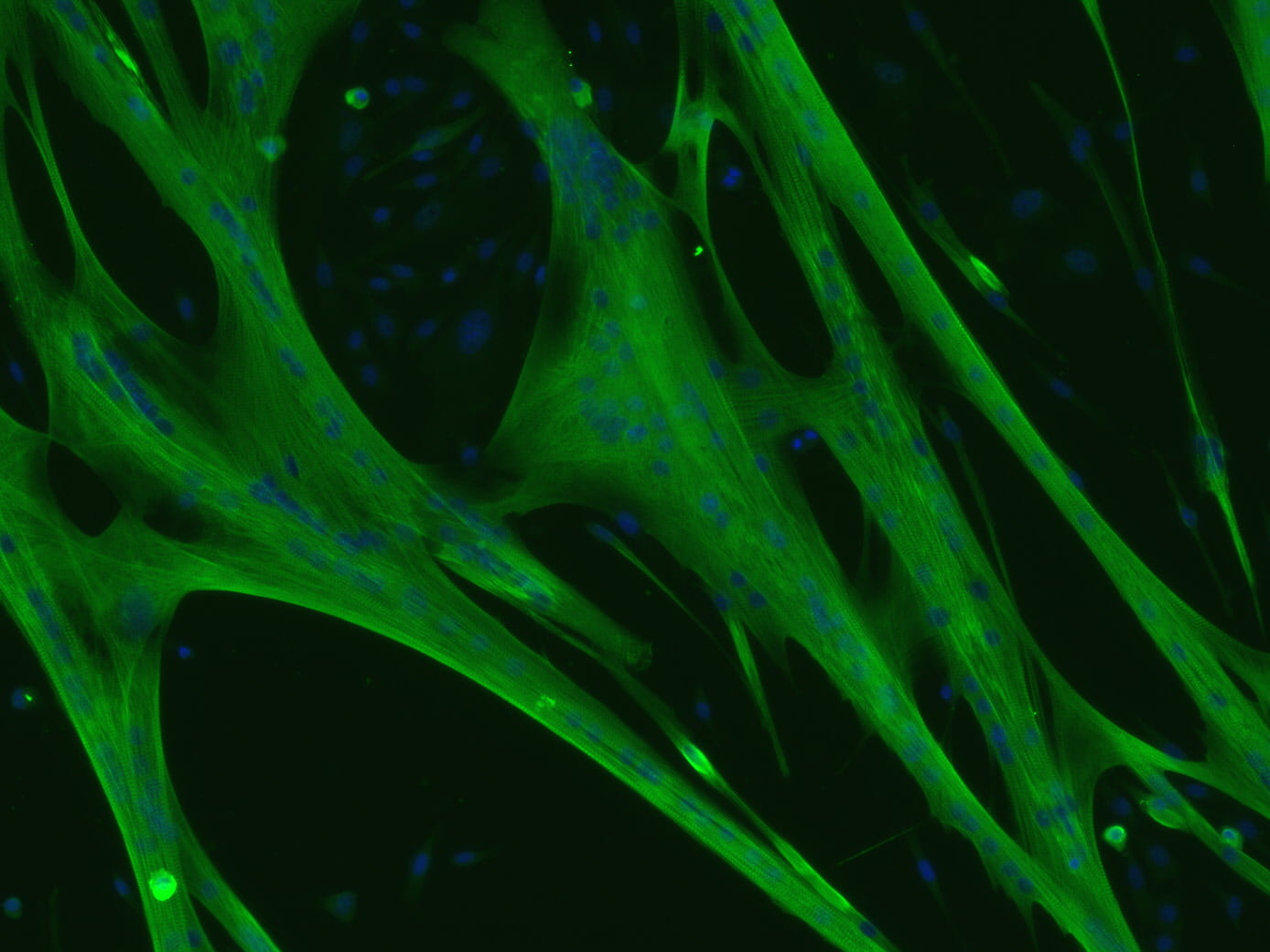 Skeletal muscle cells