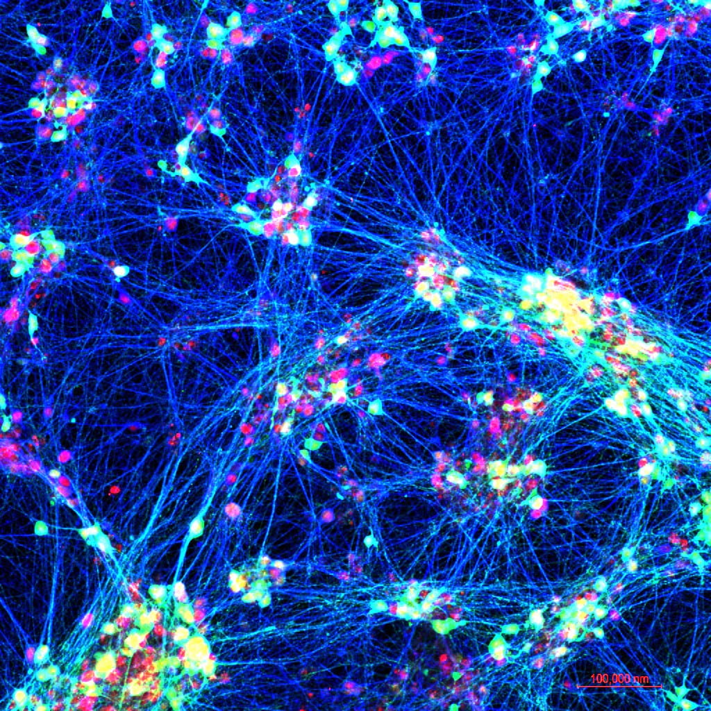 Microscopy image of neurons.